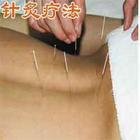 针炙为什么能减肥