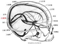 关于医学问题---左横窦