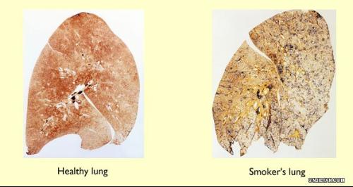 ���̵�Σ��
���������е��к��ɷְ���һ����̼����Ŷ����������ࡢ���ࡢ���ࡢ���ࡢ�������ʻ����������������໷�������ӻ��廯����ؽ���Ԫ�ء��л�ũҩ�ȡ������ж�������ѧ���ã�������
1.�Ժ�����ճĤ������֢�̼�����ȩ�ࡢ���������ϩ����
2.��ϸ�������������ã������ࡢ���ࡢ�ؽ���Ԫ�ء�
3.ʹ�˲���������ã�����Ŷ�������
4.����������°����ã���໷�����ı������Լ��ӡ����׻�����������-�����ȣ�
5.��������дٰ����ã�����໯���
6.ʹ��Ѫ��ʧȥ������������һ����̼��
�ݡ������������������̲�Σ���ǵ������������صĹ�����������֮һ��ͳ����ʾ��ȫ��Ŀǰ���������Ѵﵽ3.5�ڣ�ռ������������ʮ��֮һ��ÿ���н�500�����������̲��йصļ������ҹ�Լ��100��ר�ҹ���δ��30���ڣ����̲ݴ����ļ�����������������أ�������������������5��51�յ�ʮ�Ÿ���������������Ϊ���̲�������������
��ʵ��������������500�����ʷ�ˣ�15���ͳ���ӡ�ڰ��˾Ϳ�ʼ����Ҷ��1881����̵���������Ѹ����ȫ��Χ���У�������ϵͳ������Ѫ�ܼ�����Ҳ��֮������
����������ּ���ͼƬ��Ҳ����������һ�£�����ã�������������
